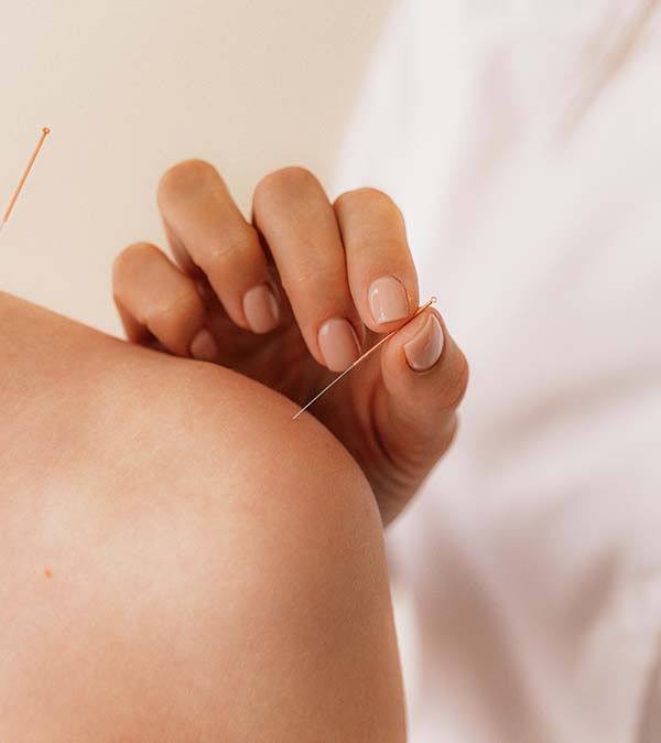 BENEFITS OF COMBINING NATUROPATHIC MEDICINE AND ACUPUNCTURE