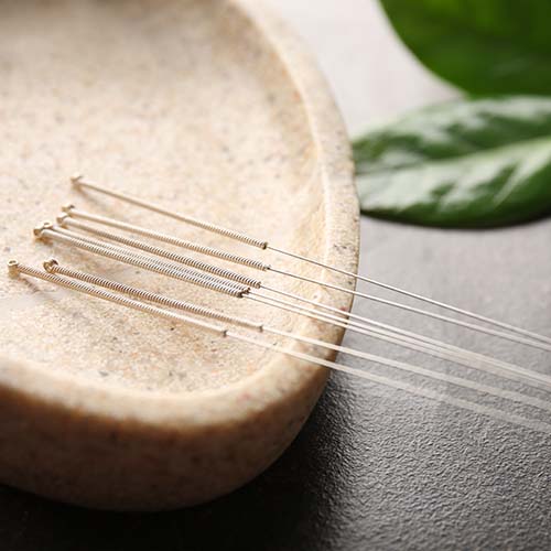 Acupuncture
